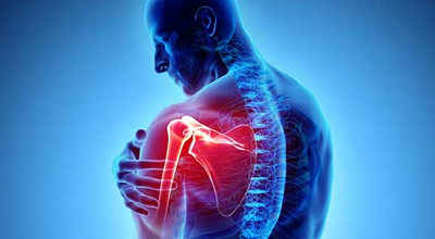 Shoulder Pain